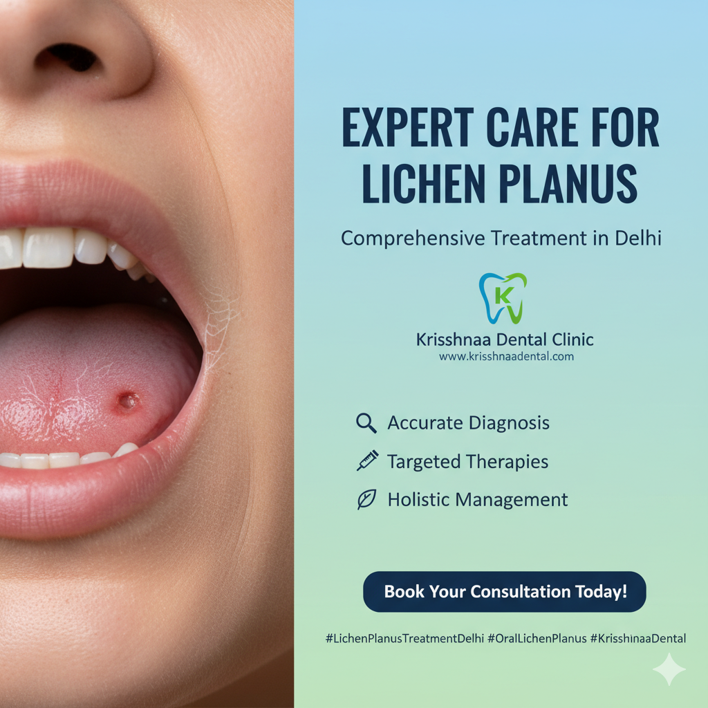 Expert Care for Lichen Planus in Delhi: Your Path to Relief at Krisshnaa Dental Clinic